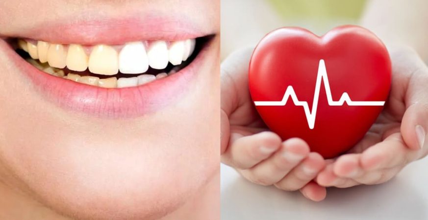 Hay mucha conexión entre la salud dental y el corazón
