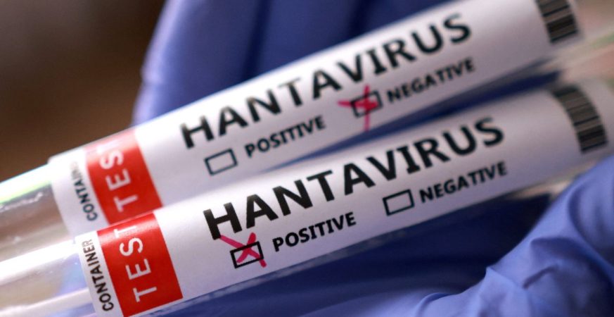 Tres muertes por Hantavirus en Venezuela