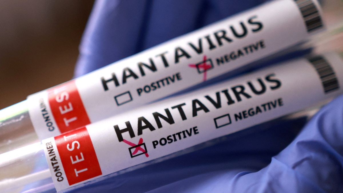 Tres muertes por Hantavirus en Venezuela